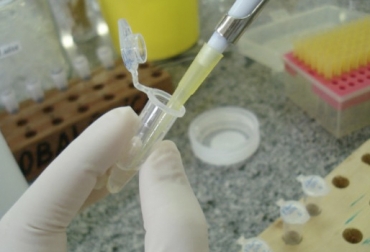 El ph del semen